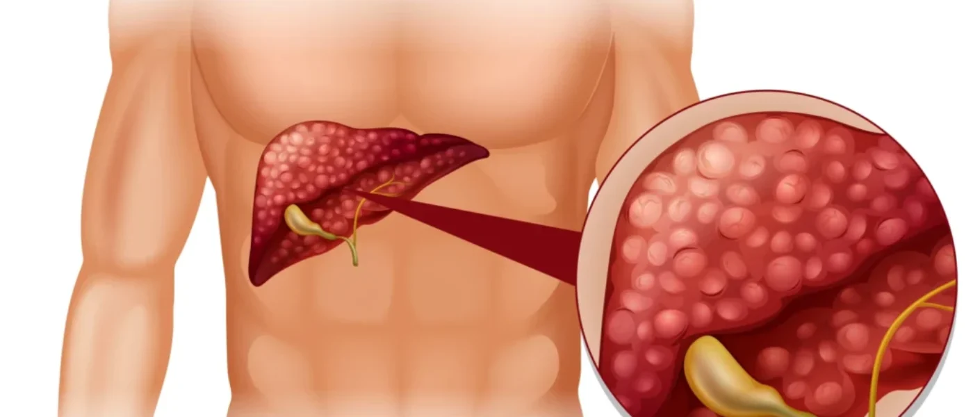 Pečeň v ohrození: Táto rastlinka ochráni váš „chemický filter“